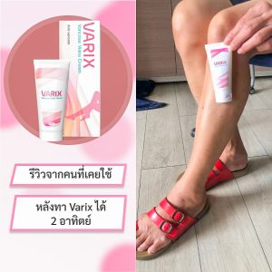 varix